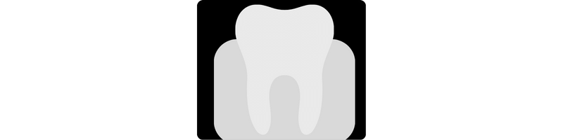Types of Dental X-Ray we use and their safety