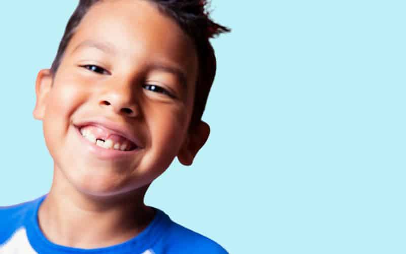 a boy smiles at the camera revealing a missing tooth